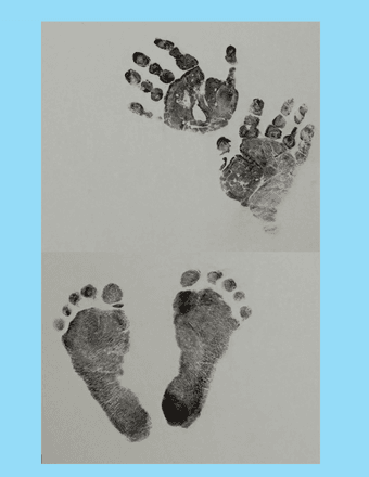 Lincoln Bradley Obituary